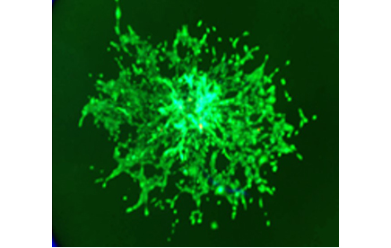 Modèles prédictifs 3D pour anticiper l’agressivité du cancer du rein