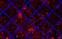 Une plate-forme in vitro imite le microenvironnement tumoral du cancer du pancréas
