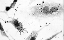 Un inhibiteur de la voie de signalisation du TGFß comme traitement de la maladie de Chagas
