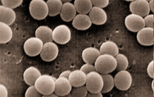 Characterizing the proteo-virulome of Staphylococcus aureus